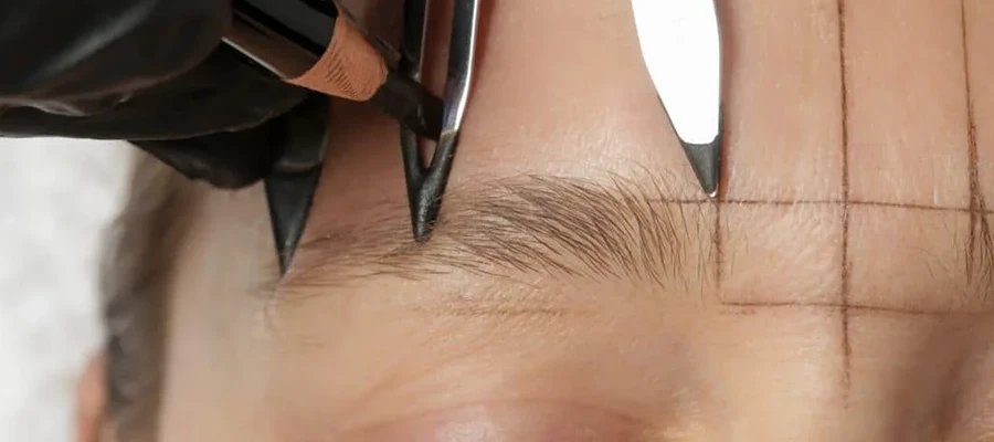 Eyebrow Transplant