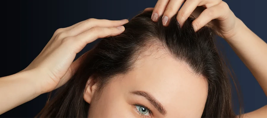 Female Hair Transplant