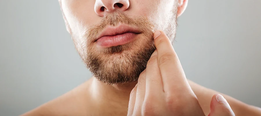 Moustache Transplant