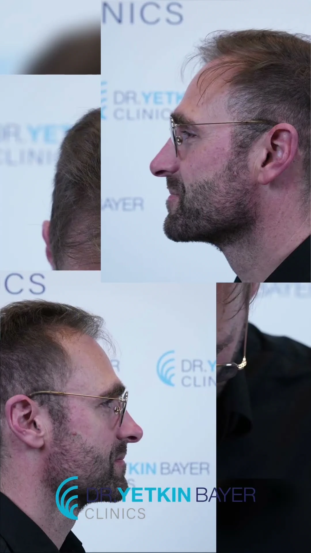 Start_Frame (1)_2026