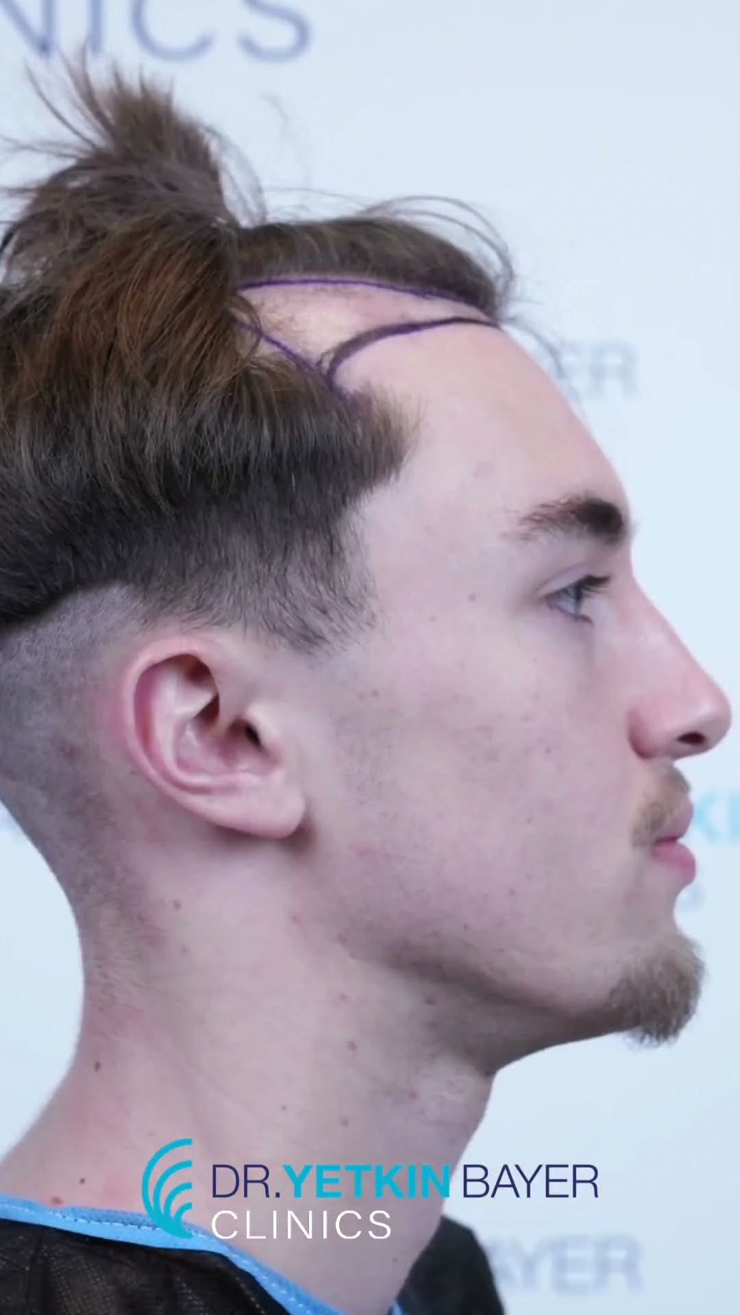 Start_Frame (2)_2026