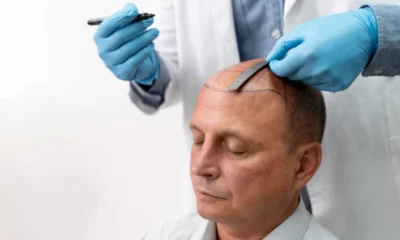 hair-transplant-in-turkey-for-us-patients-900x506